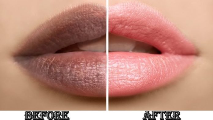 How to get pink lips fast permanently